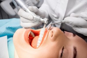 Professional teeth cleaning