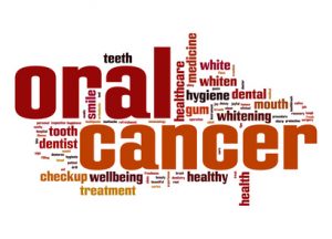 Oral cancer screening