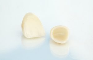 porcelain crowns