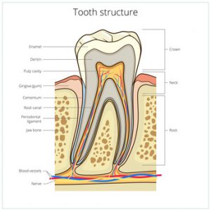 root canal treatment